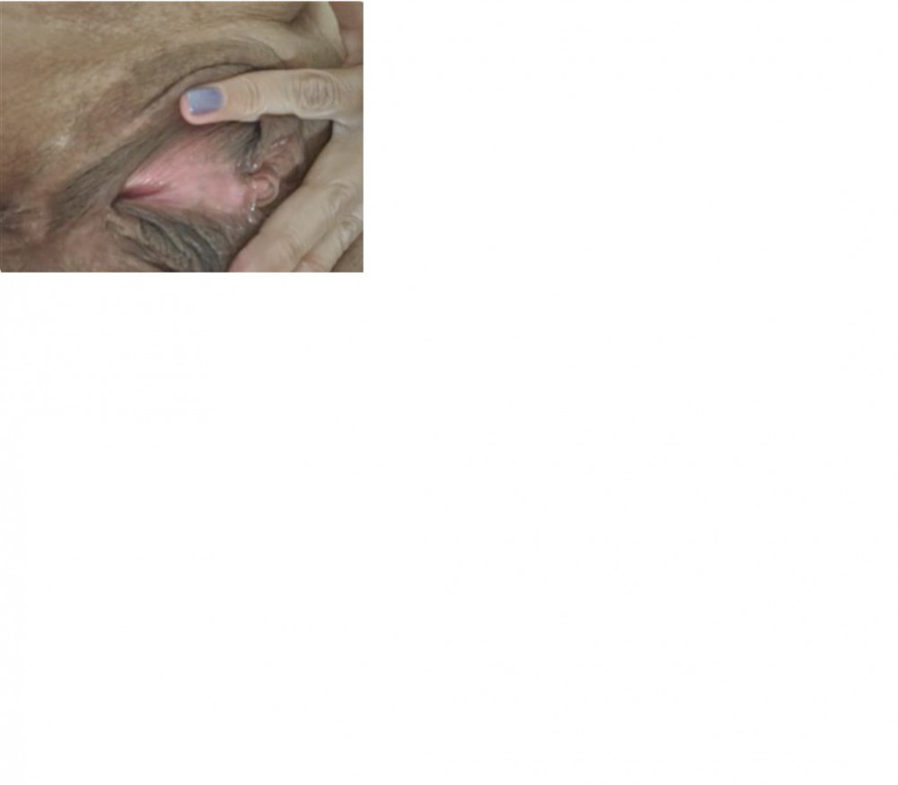 slet L.jpg